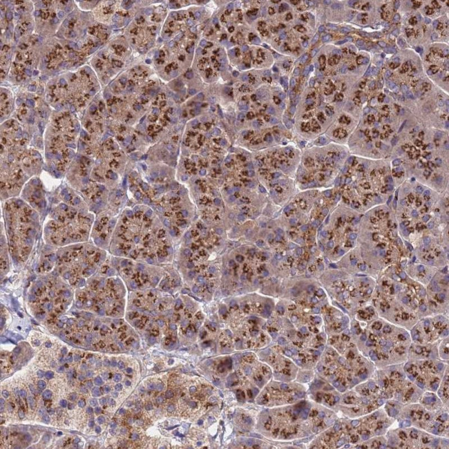 HPS3 Antibody in Immunohistochemistry (Paraffin) (IHC (P))
