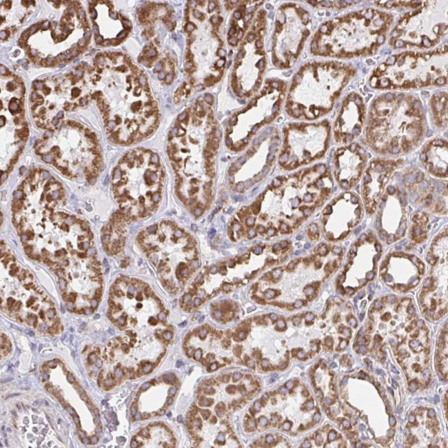 HuR Antibody in Immunohistochemistry (Paraffin) (IHC (P))