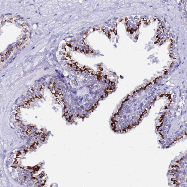PRY Antibody in Immunohistochemistry (Paraffin) (IHC (P))