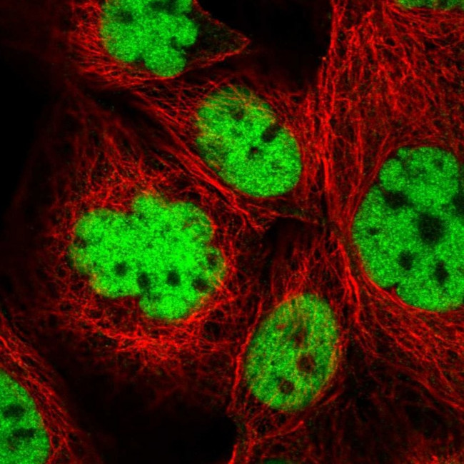 Pokemon Antibody in Immunocytochemistry (ICC/IF)