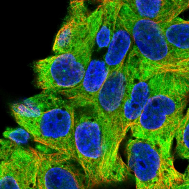 HIP Antibody in Immunocytochemistry (ICC/IF)