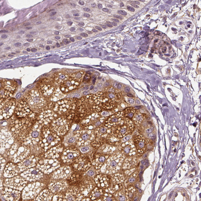 ERV3 Antibody in Immunohistochemistry (Paraffin) (IHC (P))