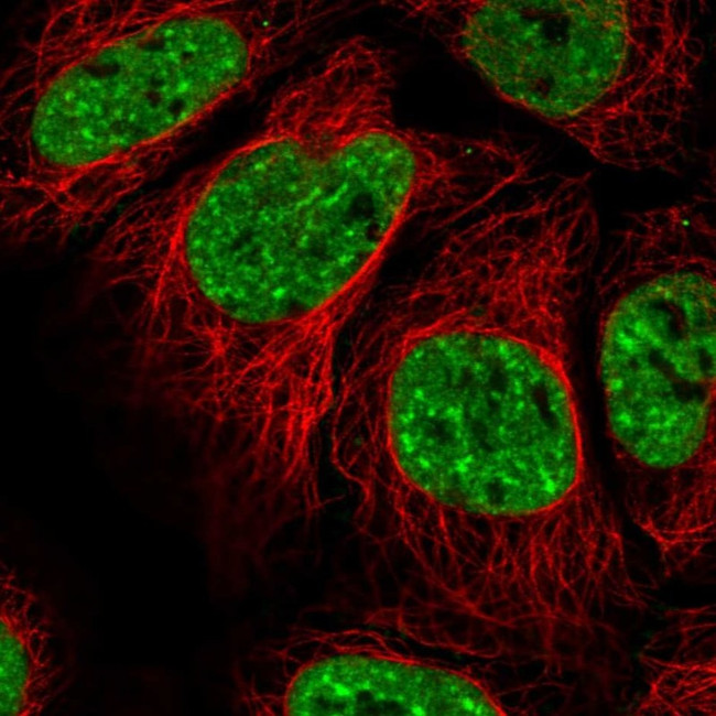 EVI1 Antibody in Immunocytochemistry (ICC/IF)