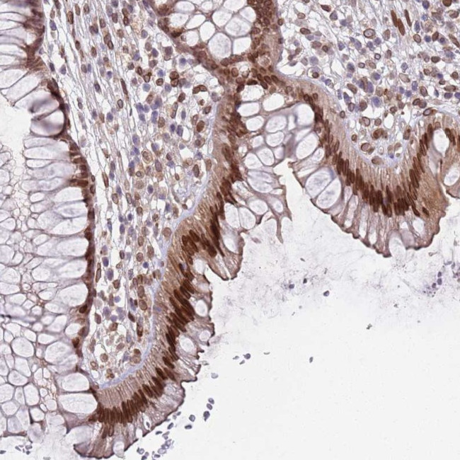 C1orf145 Antibody in Immunohistochemistry (Paraffin) (IHC (P))