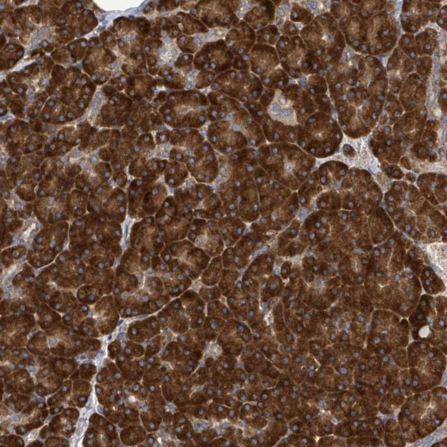 NOMO1 Antibody in Immunohistochemistry (Paraffin) (IHC (P))