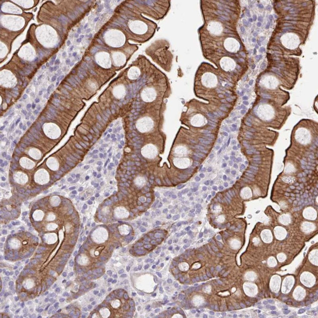 PTPN3 Antibody in Immunohistochemistry (Paraffin) (IHC (P))