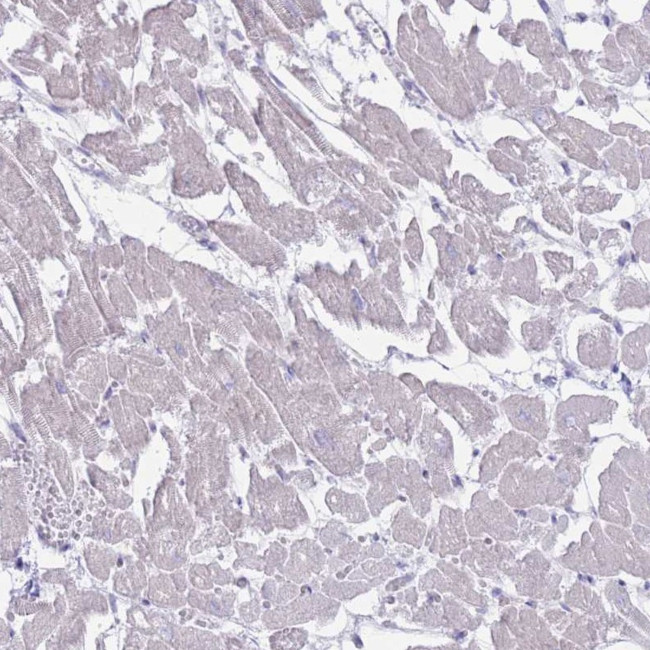 MYBPC2 Antibody in Immunohistochemistry (Paraffin) (IHC (P))