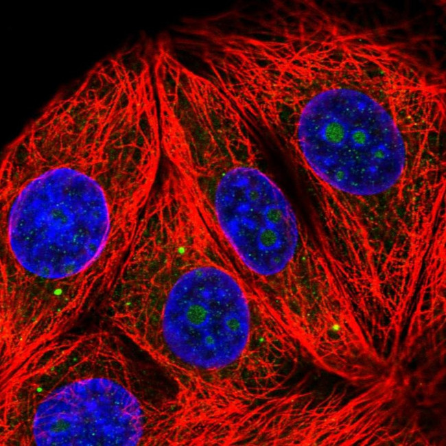 RPL7A Antibody in Immunocytochemistry (ICC/IF)