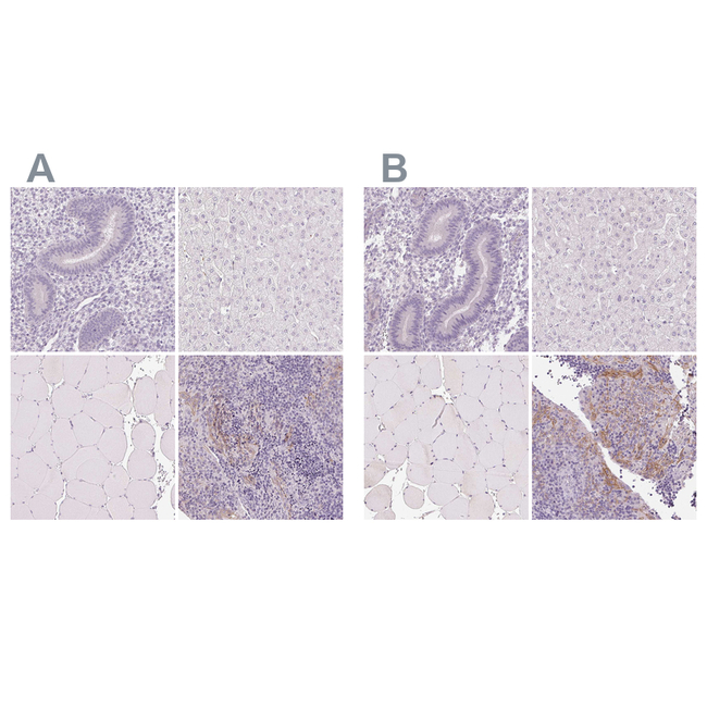 Desmoglein 3 Antibody in Immunohistochemistry (Paraffin) (IHC (P))