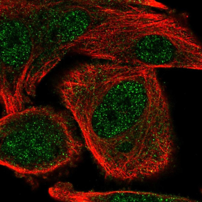 COMMD5 Antibody in Immunocytochemistry (ICC/IF)