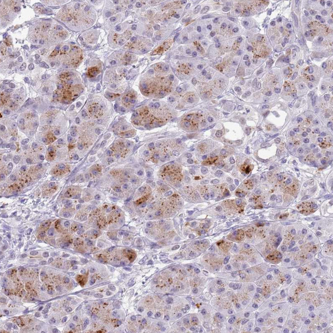 Chymotrypsin Antibody in Immunohistochemistry (Paraffin) (IHC (P))