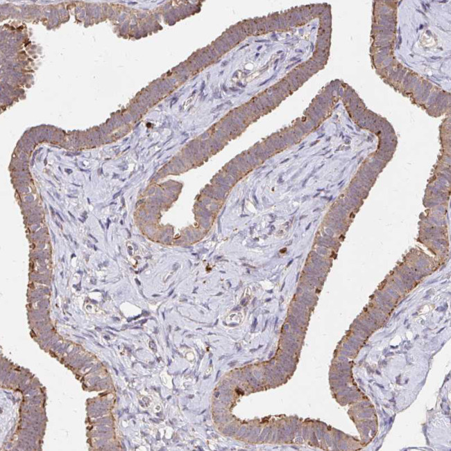 IDUA Antibody in Immunohistochemistry (Paraffin) (IHC (P))