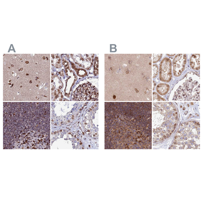 LAP1 Antibody in Immunohistochemistry (Paraffin) (IHC (P))