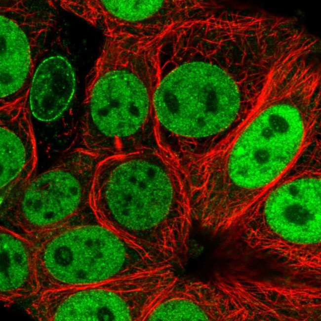 NUP50 Antibody in Immunocytochemistry (ICC/IF)