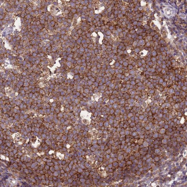 CD53 Antibody in Immunohistochemistry (Paraffin) (IHC (P))