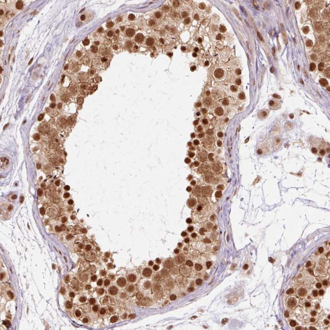 CSTF1 Antibody in Immunohistochemistry (Paraffin) (IHC (P))