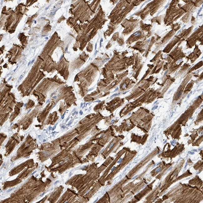 SIRPB1 Antibody in Immunohistochemistry (Paraffin) (IHC (P))
