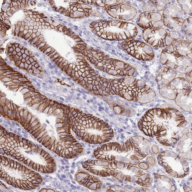 PRR23A Antibody in Immunohistochemistry (Paraffin) (IHC (P))