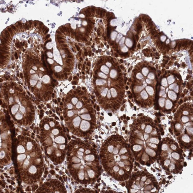 FUBP3 Antibody in Immunohistochemistry (Paraffin) (IHC (P))