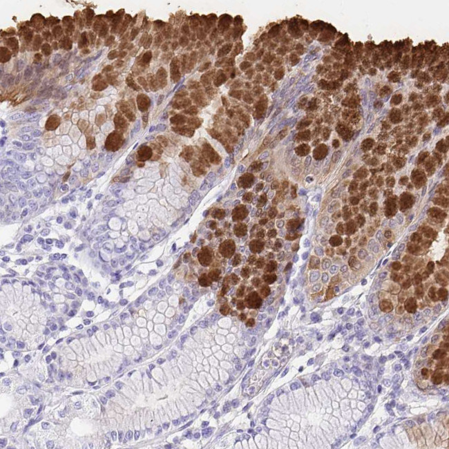 GKN1 Antibody in Immunohistochemistry (Paraffin) (IHC (P))