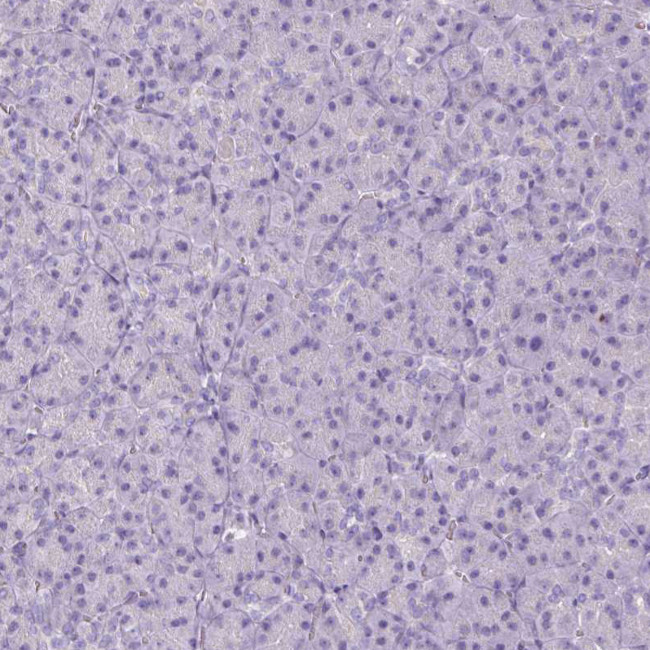 HSD11B1 Antibody in Immunohistochemistry (Paraffin) (IHC (P))