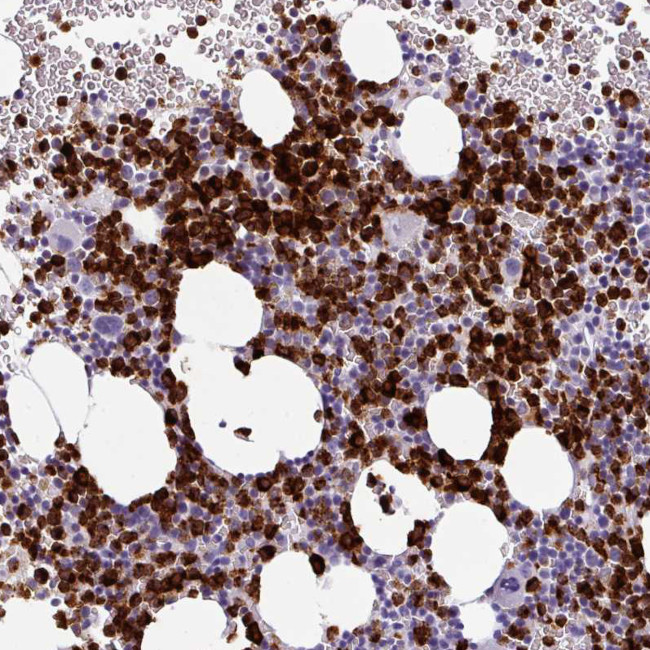 Cathepsin G Antibody in Immunohistochemistry (Paraffin) (IHC (P))