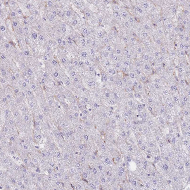 PPAP2A Antibody in Immunohistochemistry (Paraffin) (IHC (P))