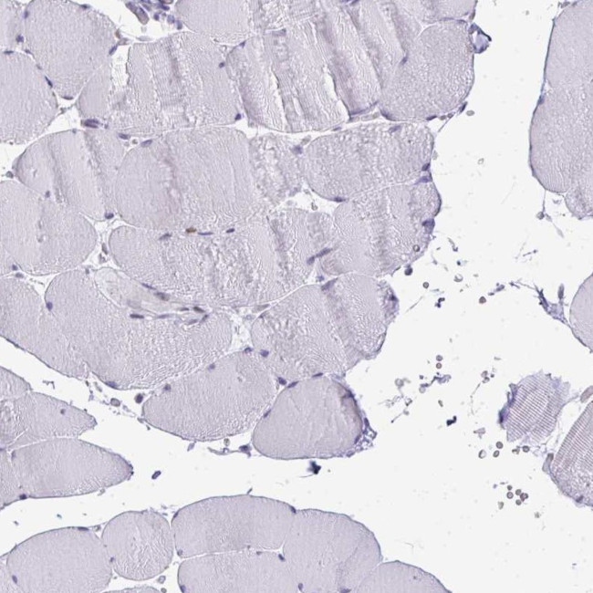 PLA2 Antibody in Immunohistochemistry (Paraffin) (IHC (P))