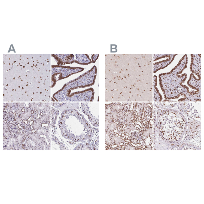 Lamin B2 Antibody in Immunohistochemistry (Paraffin) (IHC (P))