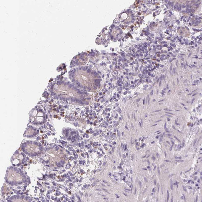 FCRL3 Antibody in Immunohistochemistry (Paraffin) (IHC (P))