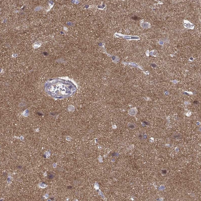 STRC Antibody in Immunohistochemistry (Paraffin) (IHC (P))