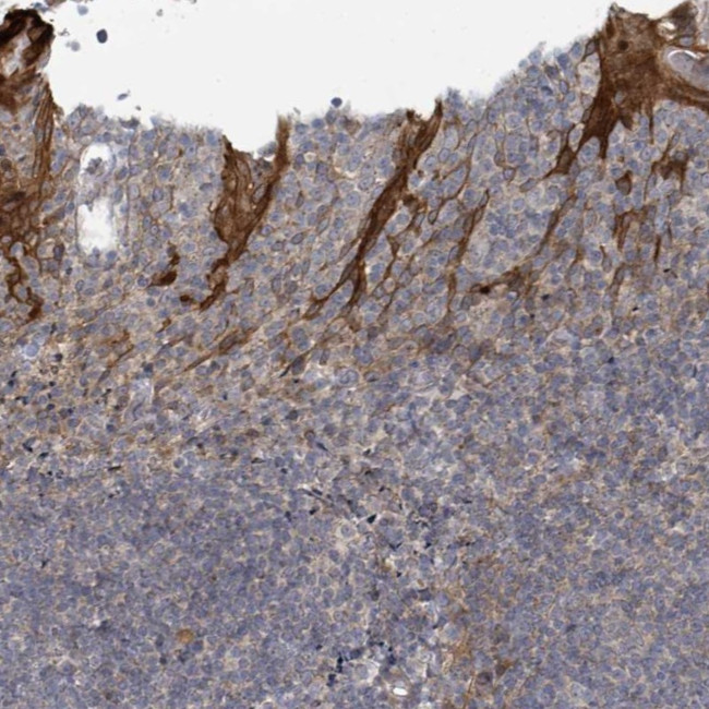 COL5A3 Antibody in Immunohistochemistry (Paraffin) (IHC (P))