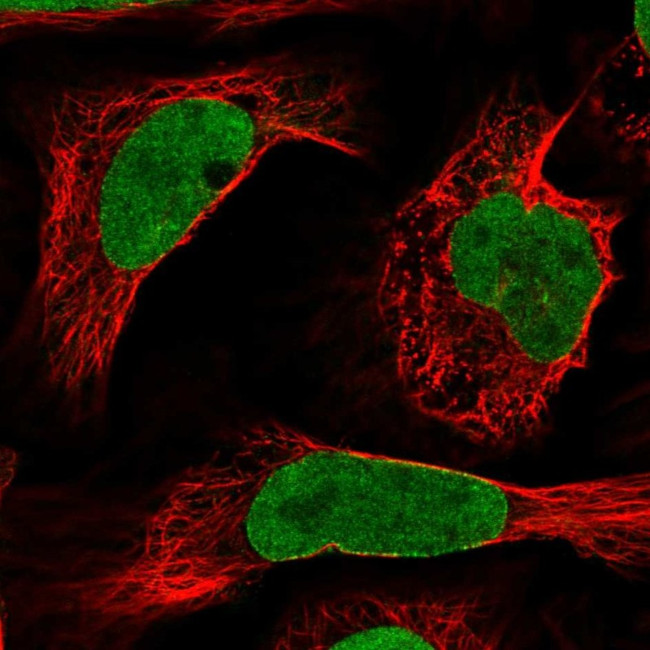 NUP50 Antibody in Immunocytochemistry (ICC/IF)