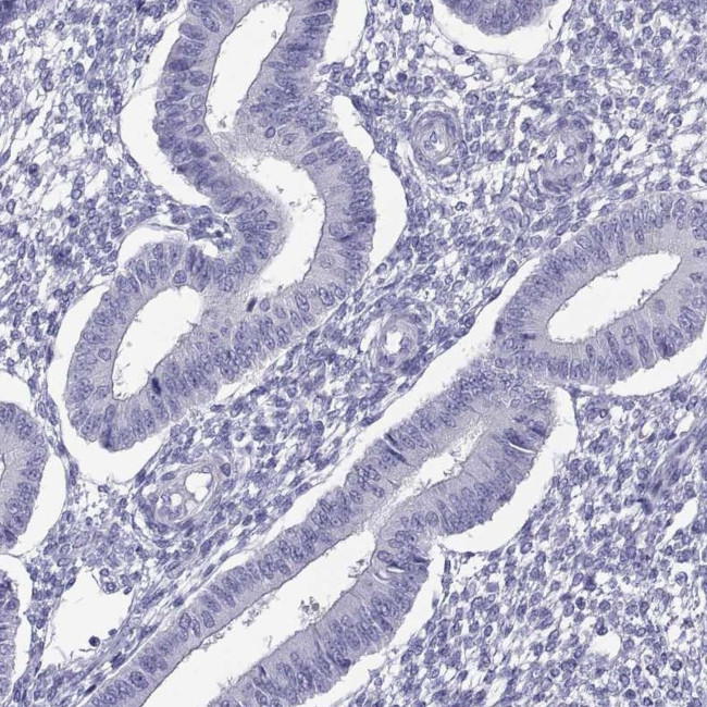 BSPH1 Antibody in Immunohistochemistry (Paraffin) (IHC (P))