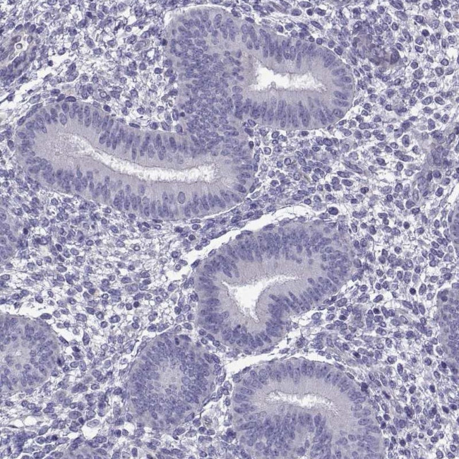 C13orf28 Antibody in Immunohistochemistry (Paraffin) (IHC (P))