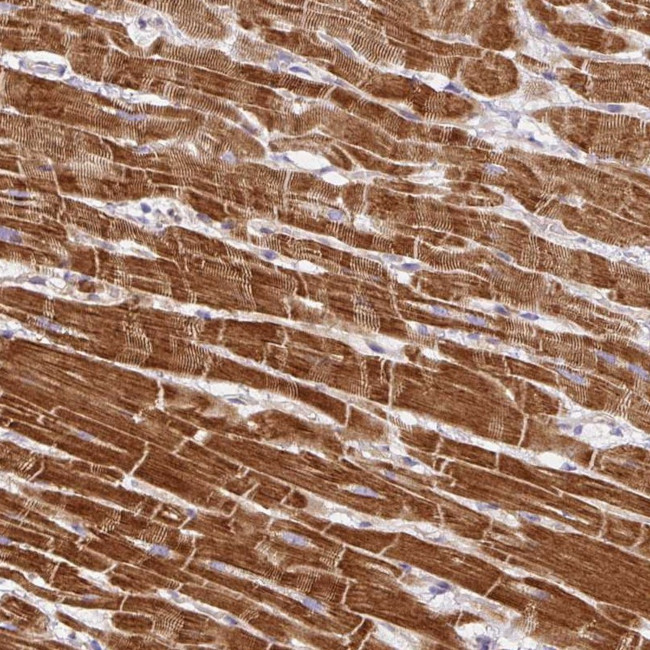 DAPK1 Antibody in Immunohistochemistry (Paraffin) (IHC (P))