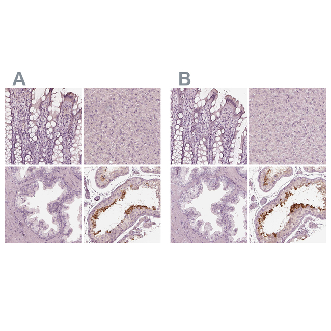 Calreticulin 3 Antibody in Immunohistochemistry (Paraffin) (IHC (P))