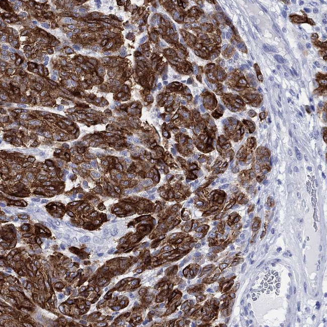 Melan-A Antibody in Immunohistochemistry (Paraffin) (IHC (P))