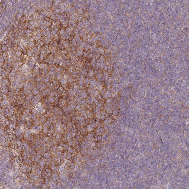 RFTN1 Antibody in Immunohistochemistry (Paraffin) (IHC (P))