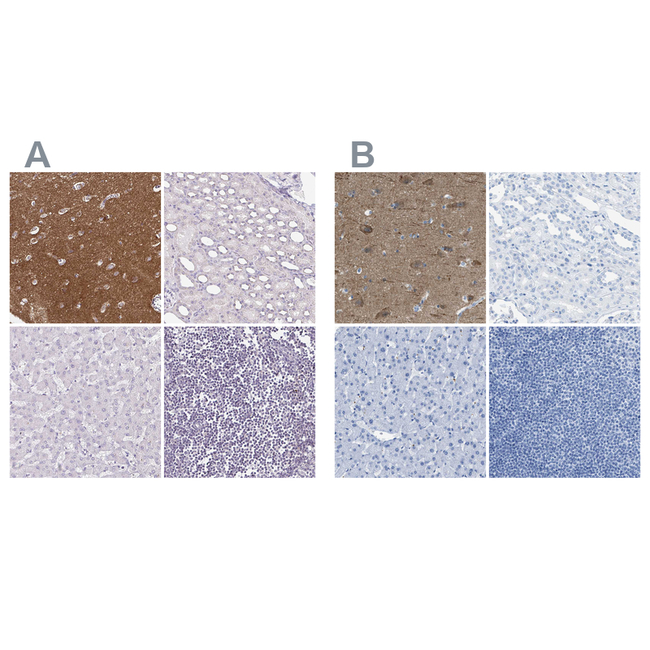 LFG Antibody in Immunohistochemistry (Paraffin) (IHC (P))