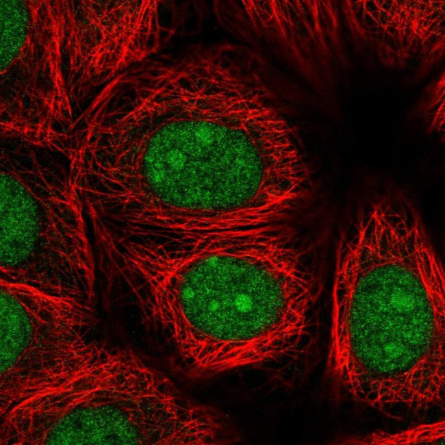 DDX41 Antibody in Immunocytochemistry (ICC/IF)