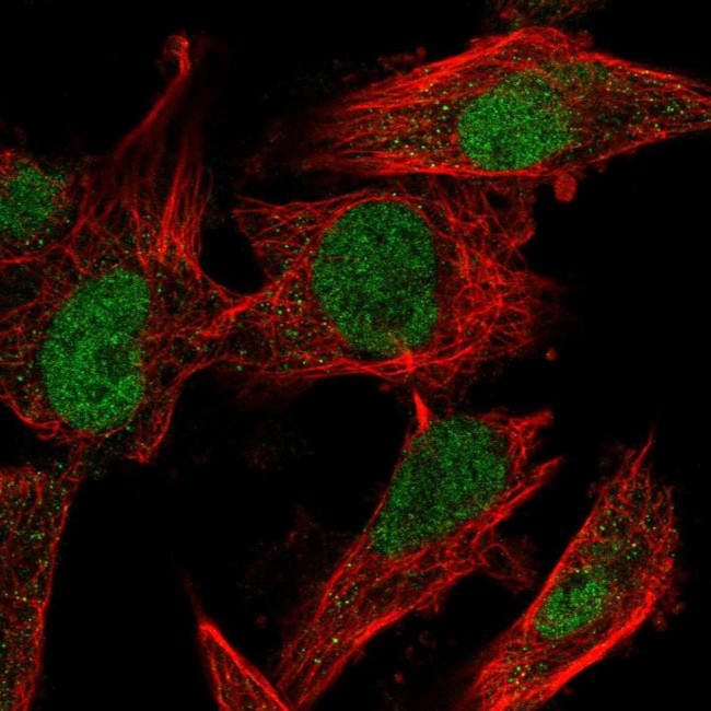 MDMX Antibody in Immunocytochemistry (ICC/IF)
