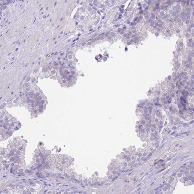 LDB3 Antibody in Immunohistochemistry (Paraffin) (IHC (P))