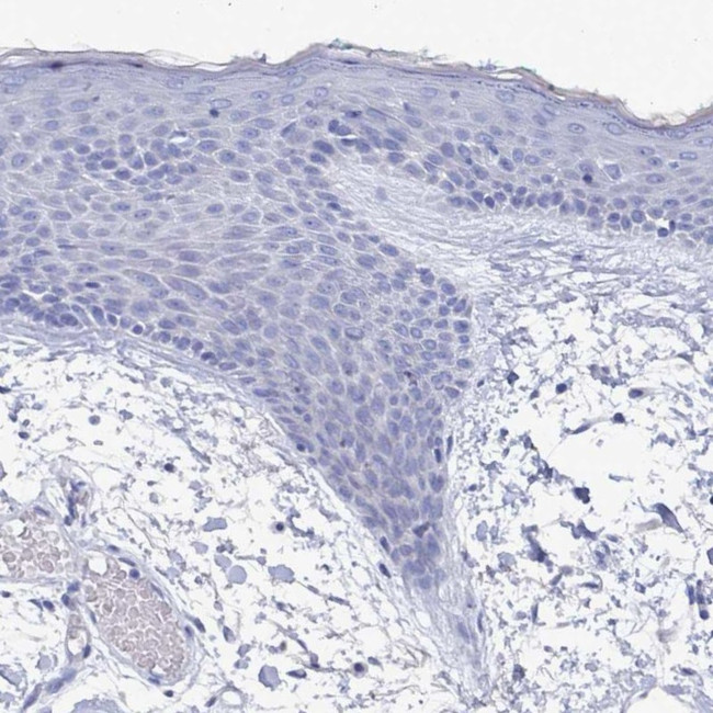 PDE4C Antibody in Immunohistochemistry (Paraffin) (IHC (P))