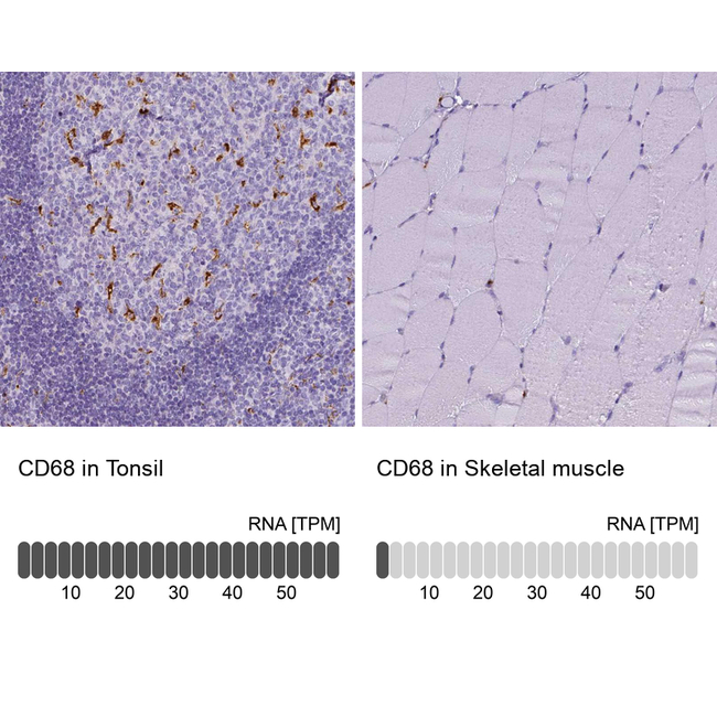 CD68 Antibody in Immunohistochemistry (Paraffin) (IHC (P))