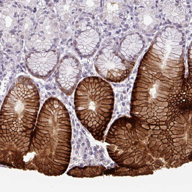 SLC5A5 Polyclonal Antibody (PA5-83945)