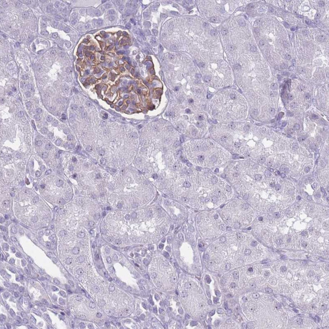 ROS1 Antibody in Immunohistochemistry (Paraffin) (IHC (P))