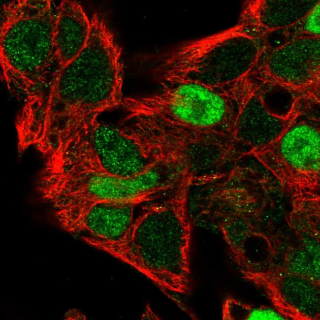 Cyclin D2 Antibody in Immunocytochemistry (ICC/IF)