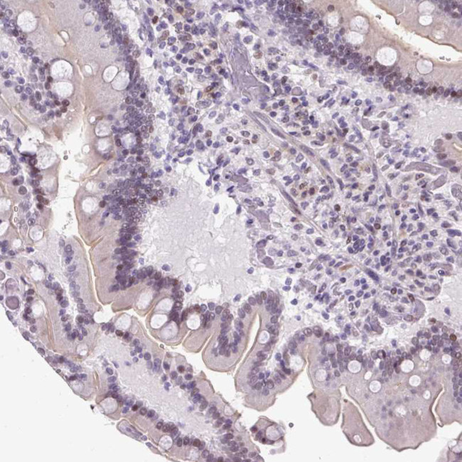 ARHGEF18 Antibody in Immunohistochemistry (Paraffin) (IHC (P))