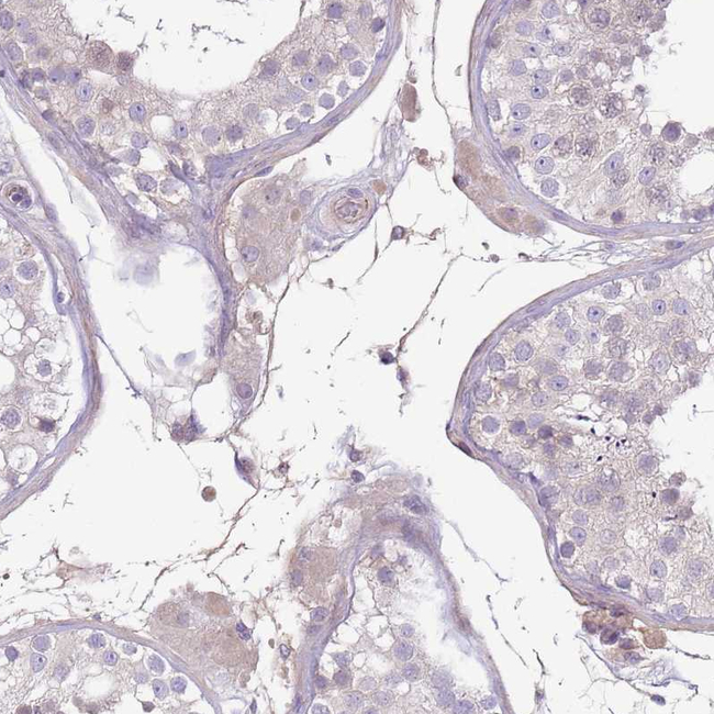 Complement Factor H Antibody in Immunohistochemistry (Paraffin) (IHC (P))